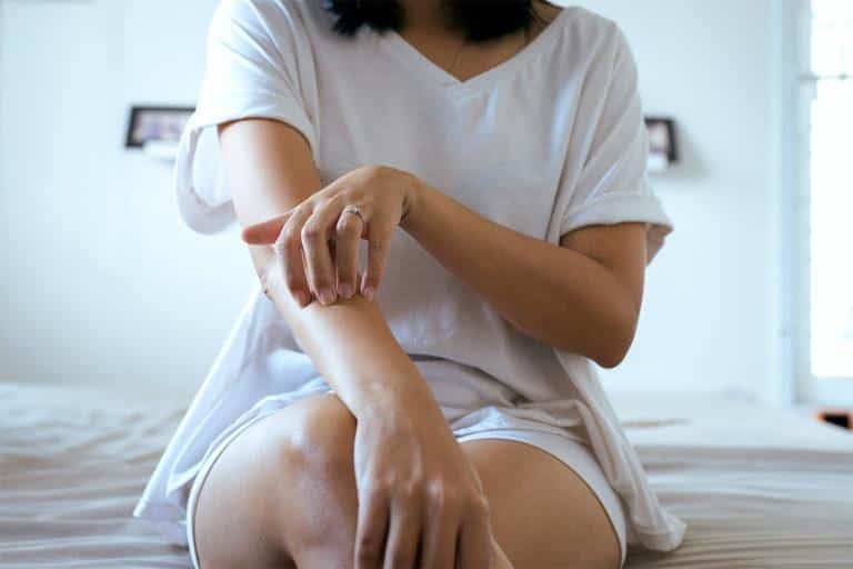 eczema dermatite atopique eczema dermatite atopique